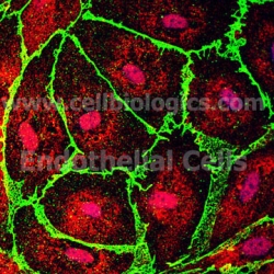 Human Primary Intestinal Mesenteric Vascular Endothelial Cells